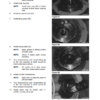 Daewoo Doosan 300LC-V Excavator Service Repair Manual - Image 7