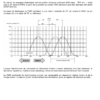 Injections MEV et MED 17.4 EP6 et EP6DT - Image 7