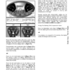 Bobcat T590 Compact Track Loader Operation Maintenance Manual - Image 14